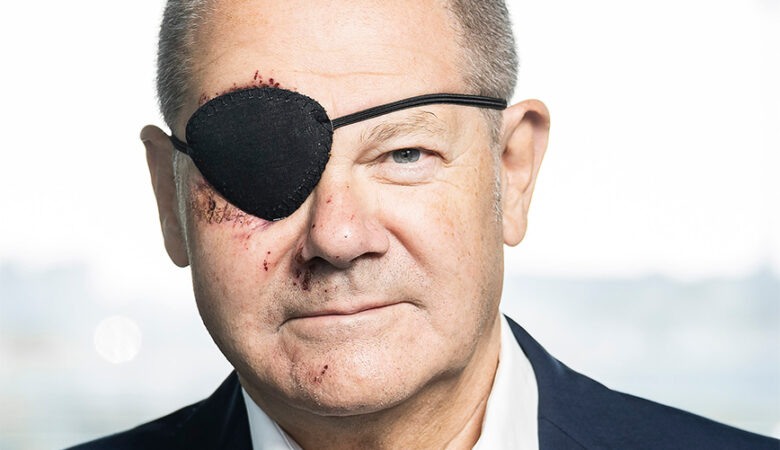 Η «πειρατική» εμφάνιση του Όλαφ Σολτς: Έβαλε κάλυμμα στο μάτι μετά το ατύχημα που είχε στη γυμναστική του