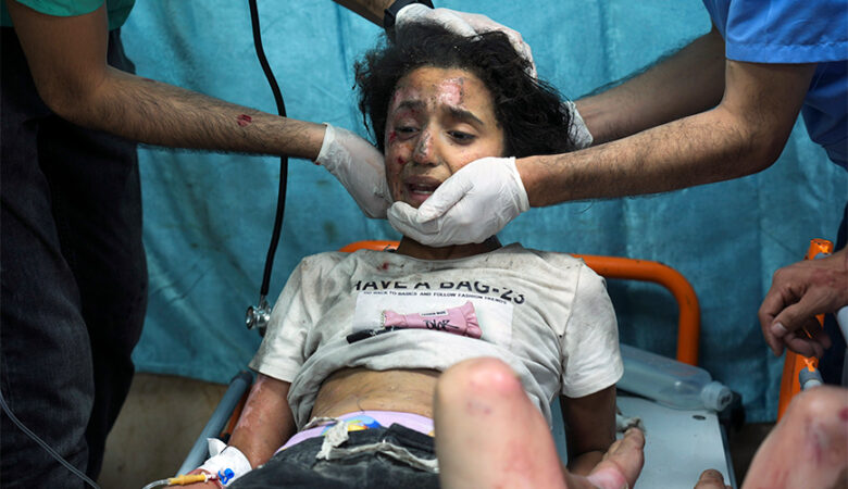 Σκληρές εικόνες στο νοσοκομείο της Γάζας που βομβαρδίστηκε – «Οι γιατροί κάνουν χειρουργεία στο έδαφος και τους διαδρόμους χωρίς αναισθησία»