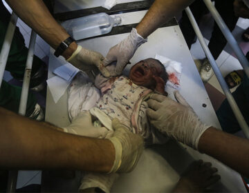 Έσωσαν μωρό από την κοιλιά Παλαιστίνιας εγκύου που σκοτώθηκε σε ισραηλινό βομβαρδισμό στη Γάζα