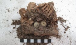 Ανασκαφή στην Αίγινα έφερε στο φως σκελετό μωρού με σύνδρομο Down που έζησε τον 13ο αιώνα π.Χ.