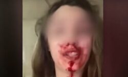 Θύμα ενδοοικογενειακής βίας κατήγγειλε σε βίντεο με αίματα στο πρόσωπο τον σύζυγό της