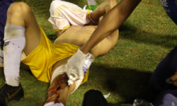 Τερματοφύλακας τραυματίστηκε από σφαίρα αστυνομικού σε σύρραξη παικτών στην Βραζιλία – Βίντεο-σοκ