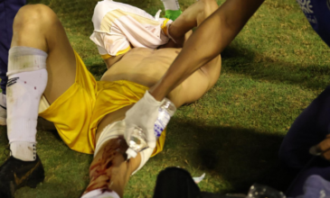 Τερματοφύλακας τραυματίστηκε από σφαίρα αστυνομικού σε σύρραξη παικτών στην Βραζιλία – Βίντεο-σοκ