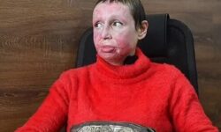 Φρίκη στη Ρωσία: Βασάνισε, «σταύρωσε» και έβαλε φωτιά στη σύντροφό του