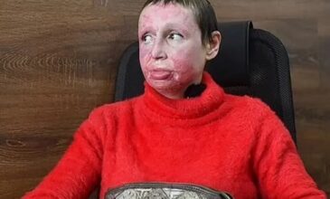 Φρίκη στη Ρωσία: Βασάνισε, «σταύρωσε» και έβαλε φωτιά στη σύντροφό του