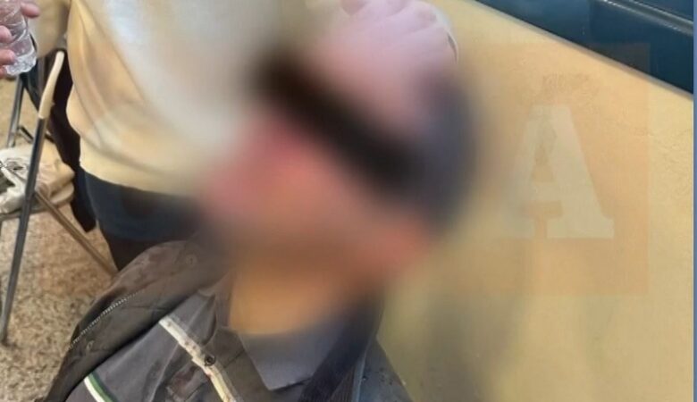 Εισβολή κουκουλοφόρων σε εκδήλωση στη Νομική – «Δεν έχω δει ξανά τόση βία στο Πανεπιστήμιο»