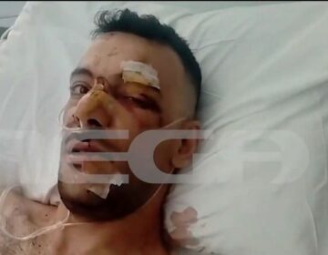 Σοκάρει η επίθεση με μαχαίρι σε 35χρονο στην Μυτιλήνη: «Έχει τρύπες σε πνεύμονα, διάφραγμα και του κόπηκαν οι μύες»