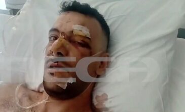 Σοκάρει η επίθεση με μαχαίρι σε 35χρονο στην Μυτιλήνη: «Έχει τρύπες σε πνεύμονα, διάφραγμα και του κόπηκαν οι μύες»