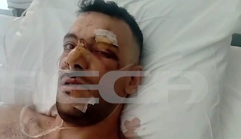 Σοκάρει η επίθεση με μαχαίρι σε 35χρονο στην Μυτιλήνη: «Έχει τρύπες σε πνεύμονα, διάφραγμα και του κόπηκαν οι μύες»
