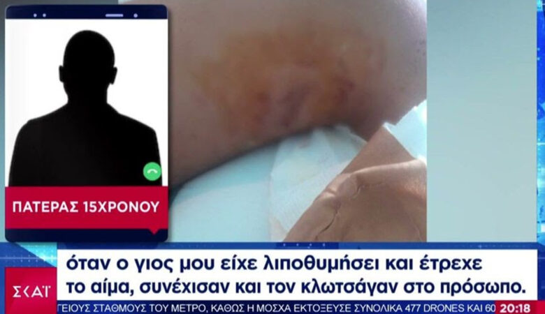 Επίθεση με σουγιά δέχθηκε 15χρονος μέσα σε λεωφορείο στην Πετρούπολη – Με ποινικό παρελθόν οι 4 από τους 5 ανήλικους δράστες, λέει η ΕΛ.ΑΣ.
