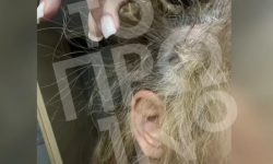 Άγρια επίθεση δέχθηκε 43χρονη από γνωστό πλαστικό χειρουργό στη μέση της Συγγρού – Της ξερίζωσε τα μαλλιά και την χτύπησε στο κεφάλι