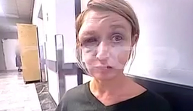 «Τον αγαπώ», σοκάρει η εικόνα και η αντίδραση της 40χρονης στο Κορωπί μετά τον ξυλοδαρμό της