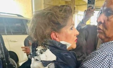 Βουλευτής τραυματίστηκε από εκρηκτικό μηχανισμό έξω από το Κογκρέσο της Ονδούρας