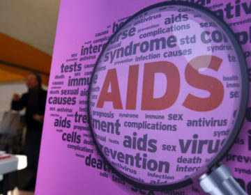 Ελπίδες για τη θεραπεία του AIDS γεννά νέα έρευνα
