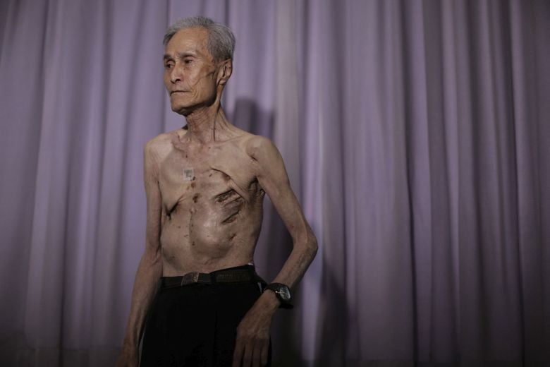 «Έφυγε» από τη ζωή ο εμβληματικός επιζών της ατομικής βόμβας στο Ναγκασάκι