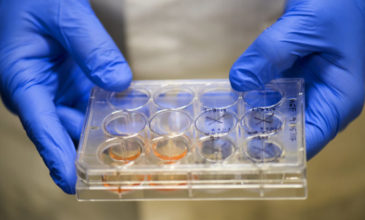 Επιστήμονες δημιούργησαν έμβρυα προβάτων που περιέχουν ανθρώπινα κύτταρα