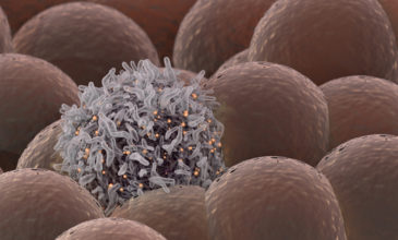 Ανακαλύφθηκε το πρώτο βακτήριο που προστατεύει από καρκίνο